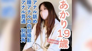 [Amateur First Shoot, Face Revealed] Akari (19) Gets Her Asshole Licked, And Then We Film The Inside Of Her Vagina And Anus, Followed By A Separate Angle Video Of Anal Penetration
